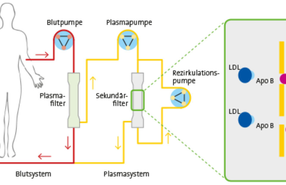 Grafik lipidaphereseverfahren