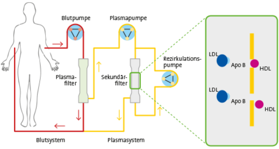 Grafik lipidaphereseverfahren